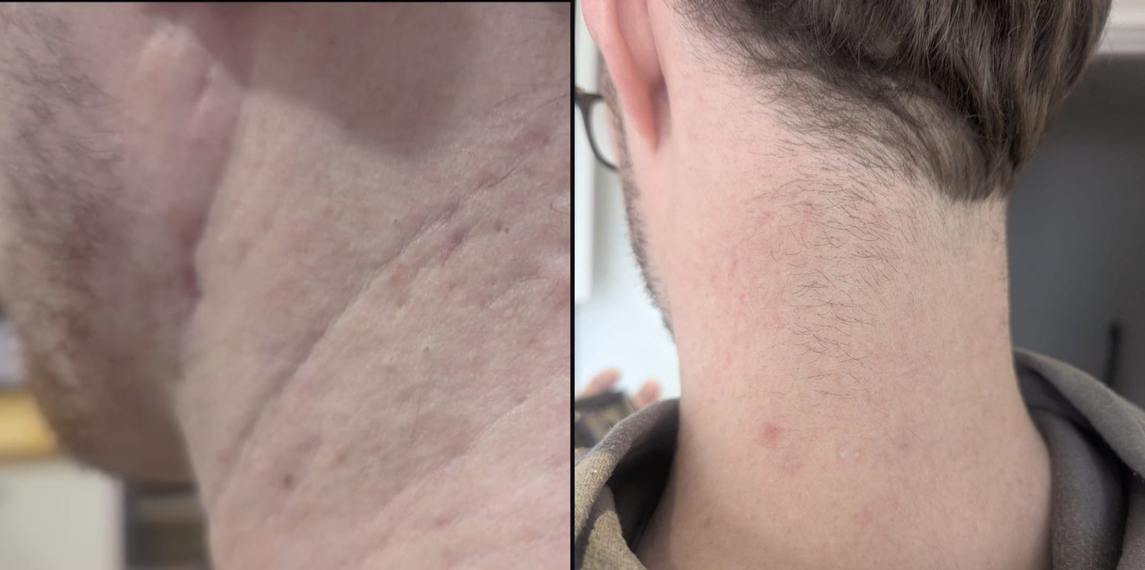 Before and after — Texture Smoothing